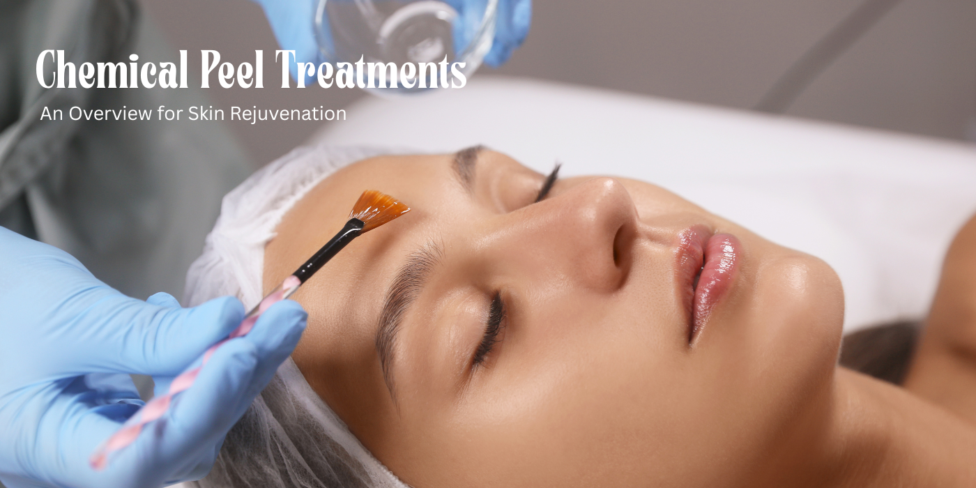 chemical peel treatments